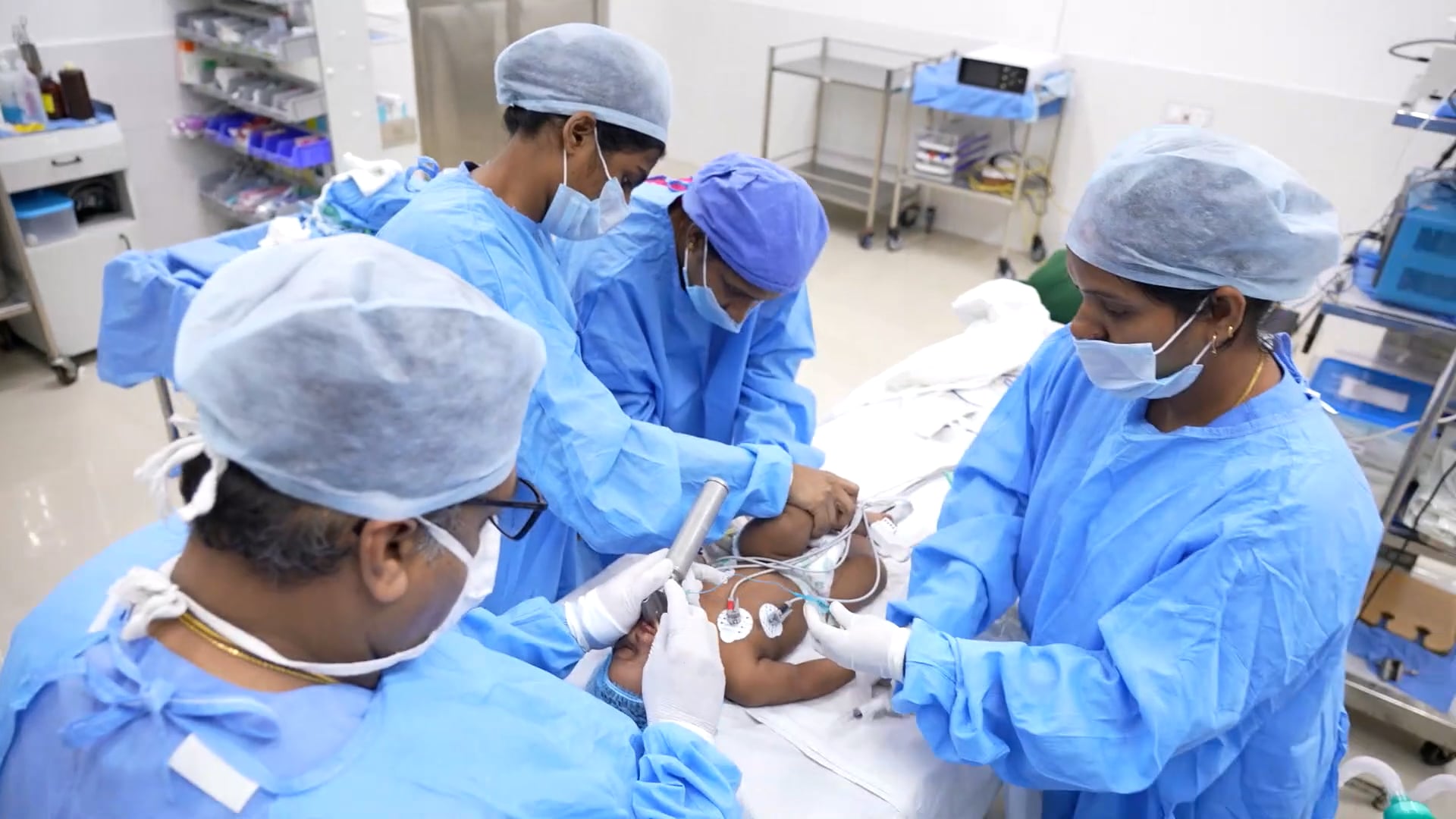 Difficult Bilateral cleft lip surgery for baby